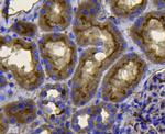 Pan Ras Antibody in Immunohistochemistry (Paraffin) (IHC (P))