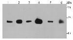 Pan Ras Antibody in Western Blot (WB)