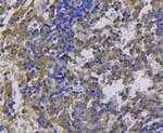 c-Met Antibody in Immunohistochemistry (Paraffin) (IHC (P))