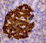 Chromogranin A Antibody in Immunohistochemistry (Paraffin) (IHC (P))