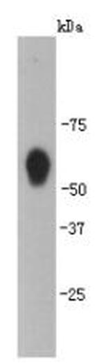 CaMKII delta Antibody in Western Blot (WB)