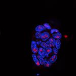 Nucleolin Antibody in Immunocytochemistry (ICC/IF)