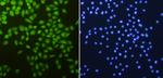 CDK2 Antibody in Immunocytochemistry (ICC/IF)