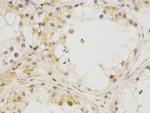 BNC1 Antibody in Immunohistochemistry (Paraffin) (IHC (P))