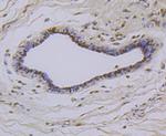 TCF7L2 Antibody in Immunohistochemistry (Paraffin) (IHC (P))