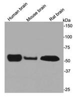 Beta III Tubulin Antibody in Western Blot (WB)