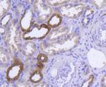 GLUT4 Antibody in Immunohistochemistry (Paraffin) (IHC (P))