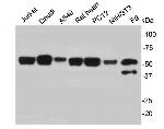 PTBP1 Antibody in Western Blot (WB)