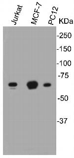 Lamin B1 Antibody in Western Blot (WB)