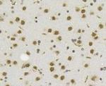 TET1 Antibody in Immunohistochemistry (Paraffin) (IHC (P))