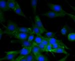 MYLK Antibody in Immunocytochemistry (ICC/IF)