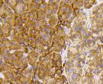 TSC2 Antibody in Immunohistochemistry (Paraffin) (IHC (P))