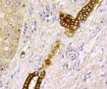 TSC2 Antibody in Immunohistochemistry (Paraffin) (IHC (P))