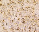 TSC2 Antibody in Immunohistochemistry (Paraffin) (IHC (P))