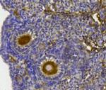 YBX1 Antibody in Immunohistochemistry (Paraffin) (IHC (P))