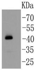 YBX1 Antibody in Western Blot (WB)