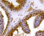 PRDX2 Antibody in Immunohistochemistry (Paraffin) (IHC (P))