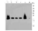 PRDX2 Antibody in Western Blot (WB)