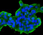 Cytochrome C Antibody in Immunocytochemistry (ICC/IF)