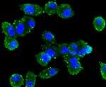 ABCA1 Antibody in Immunocytochemistry (ICC/IF)