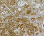 ABCA1 Antibody in Immunohistochemistry (Paraffin) (IHC (P))