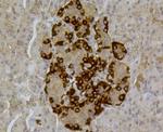 ABCA1 Antibody in Immunohistochemistry (Paraffin) (IHC (P))