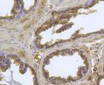 ABCA1 Antibody in Immunohistochemistry (Paraffin) (IHC (P))