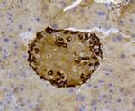 ABCA1 Antibody in Immunohistochemistry (Paraffin) (IHC (P))