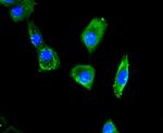 CCL3 (MIP-1 alpha) Antibody in Immunocytochemistry (ICC/IF)