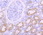 Thioredoxin 1 Antibody in Immunohistochemistry (Paraffin) (IHC (P))