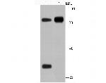 Human IgM Antibody in Western Blot (WB)