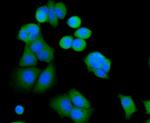 MYLK Antibody in Immunocytochemistry (ICC/IF)