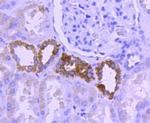 NOX4 Antibody in Immunohistochemistry (Paraffin) (IHC (P))