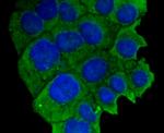 VCAM-1 (CD106) Antibody in Immunocytochemistry (ICC/IF)