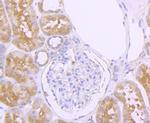 Aconitase 1 Antibody in Immunohistochemistry (Paraffin) (IHC (P))