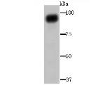 Aconitase 1 Antibody in Western Blot (WB)