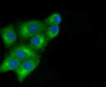 MYL2 Antibody in Immunocytochemistry (ICC/IF)