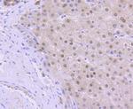 OGG1 Antibody in Immunohistochemistry (Paraffin) (IHC (P))