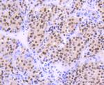 OGG1 Antibody in Immunohistochemistry (Paraffin) (IHC (P))