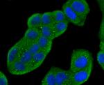 Cathepsin D Antibody in Immunocytochemistry (ICC/IF)