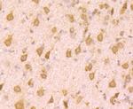 PCBP1 Antibody in Immunohistochemistry (Paraffin) (IHC (P))