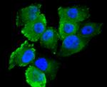Calpain 1 Antibody in Immunocytochemistry (ICC/IF)