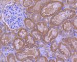 Calpain 1 Antibody in Immunohistochemistry (Paraffin) (IHC (P))