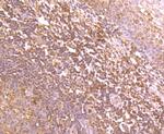 IKK beta Antibody in Immunohistochemistry (Paraffin) (IHC (P))