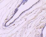 IKK beta Antibody in Immunohistochemistry (Paraffin) (IHC (P))