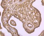 IKK beta Antibody in Immunohistochemistry (Paraffin) (IHC (P))