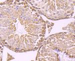 IKK beta Antibody in Immunohistochemistry (Paraffin) (IHC (P))