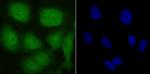 UBA3 Antibody in Immunocytochemistry (ICC/IF)