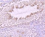 UBA3 Antibody in Immunohistochemistry (Paraffin) (IHC (P))