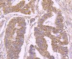 Bax Antibody in Immunohistochemistry (Paraffin) (IHC (P))